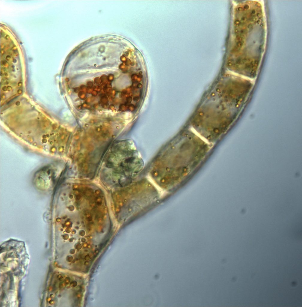 microscopic image of algae