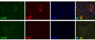 Effect of GBS infection on the efflux transporter P-glycoprotein (P-gp) in the brains of mice. Uninfected animals show expected P-gp expression co-localized with the blood vessel marker lectin (top). GBS infection results in a loss of P-gp in the cerebral vasculature where little to no P-gp is detected infected mouse brain (bottom).
