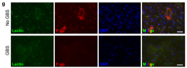 Effect of GBS infection on the efflux transporter P-glycoprotein (P-gp) in the brains of mice. Uninfected animals show expected P-gp expression co-localized with the blood vessel marker lectin (top). GBS infection results in a loss of P-gp in the cerebral vasculature where little to no P-gp is detected infected mouse brain (bottom).